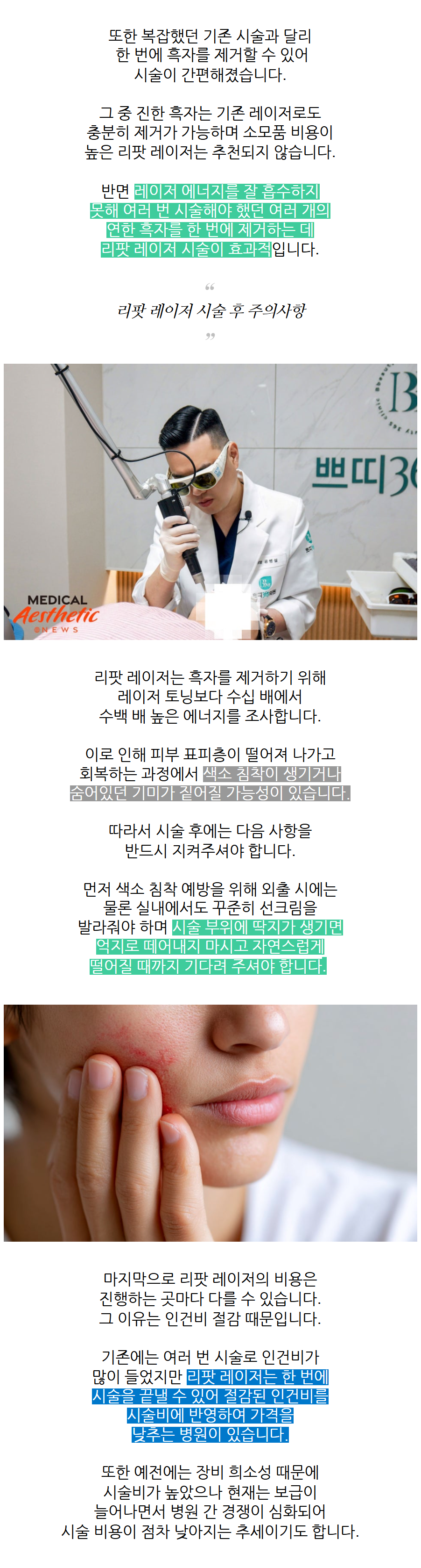 춘천 기미 흑자 색소가 비슷해 보여도 상담에서 갈리는 부분
