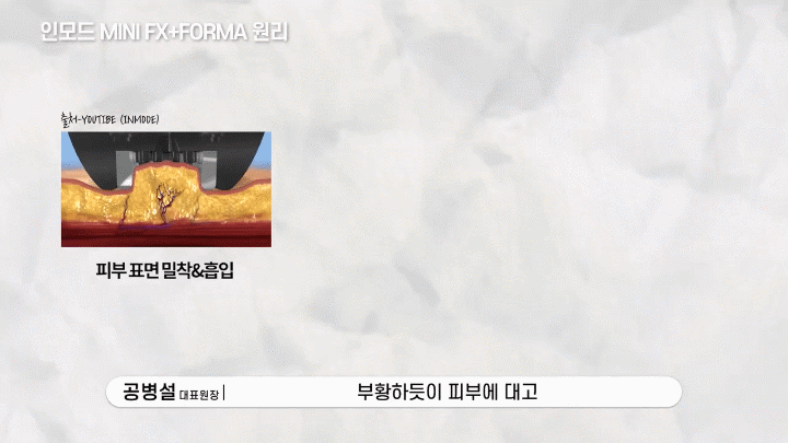 춘천인모드 얼굴선이 달라 보이지 않을까 걱정될 때 먼저 봐야 할 기준