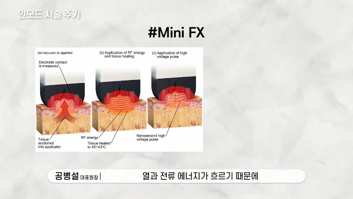 춘천인모드 얼굴선이 달라 보이지 않을까 걱정될 때 먼저 봐야 할 기준