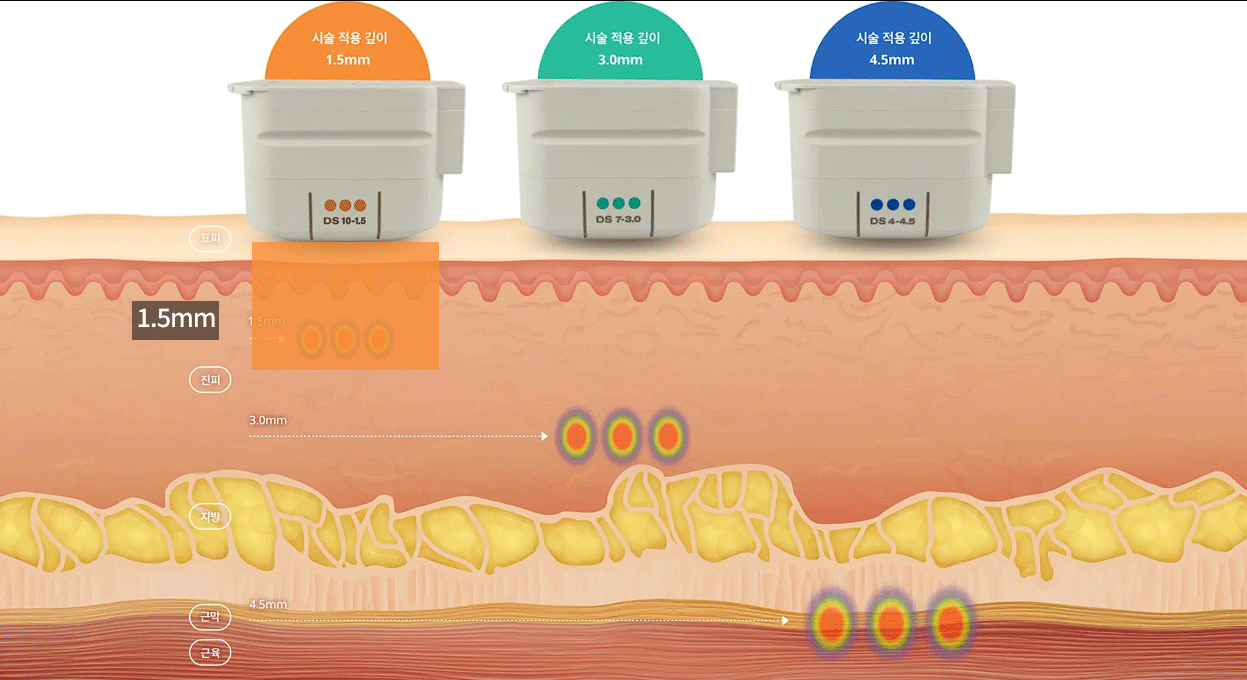 춘천써마지 상담이 망설여질 때 피부결보다 탄력의 위치를 다시 봐야 합니다