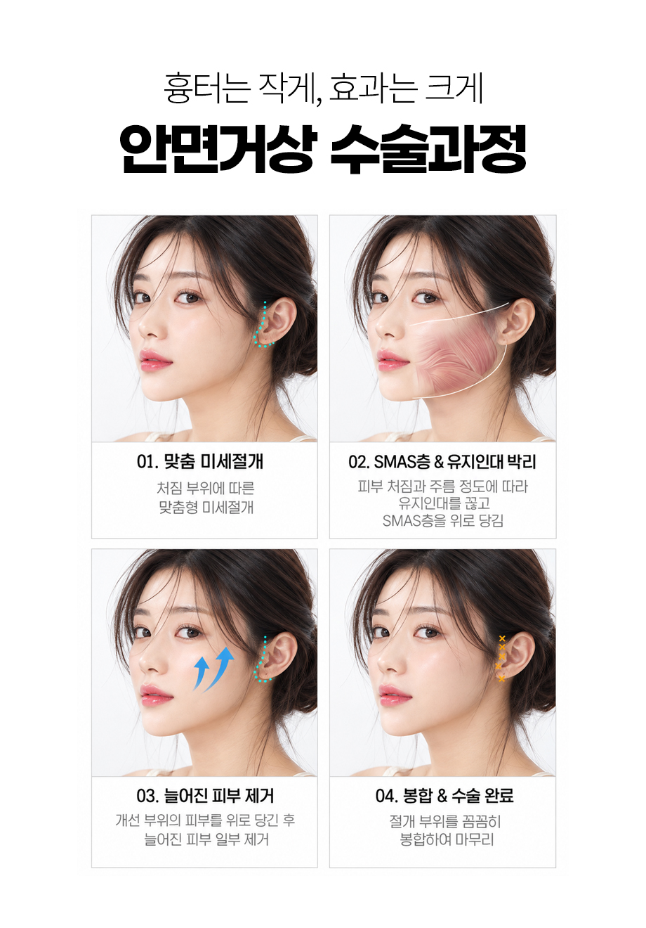 261006_안면거상_10.jpg