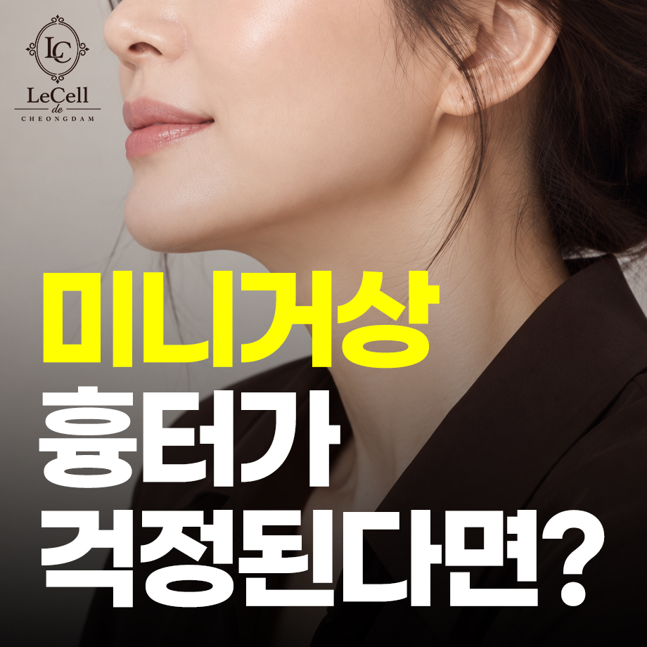 261006_안면미니거상_02.jpg