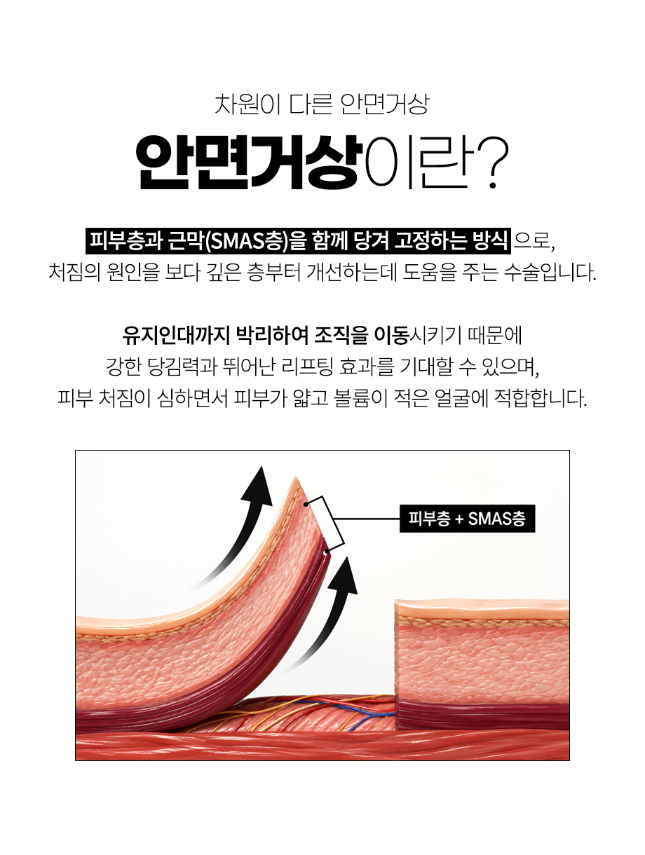 261006_안면거상_03.jpg
