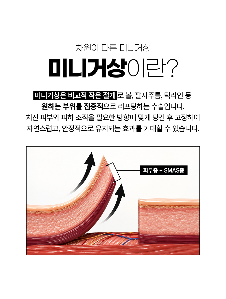 261006_안면미니거상_03.jpg