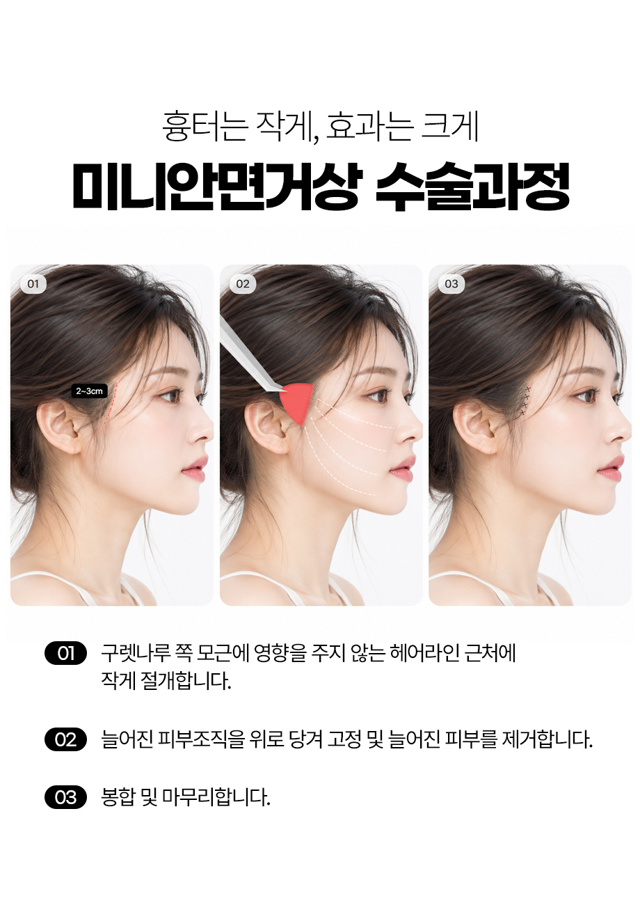 261006_안면미니거상_10.jpg