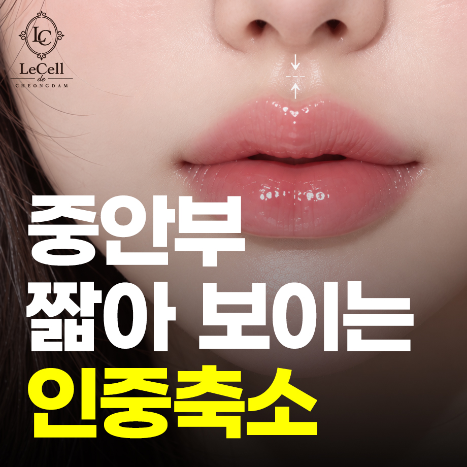 261006_인중축소_02.jpg