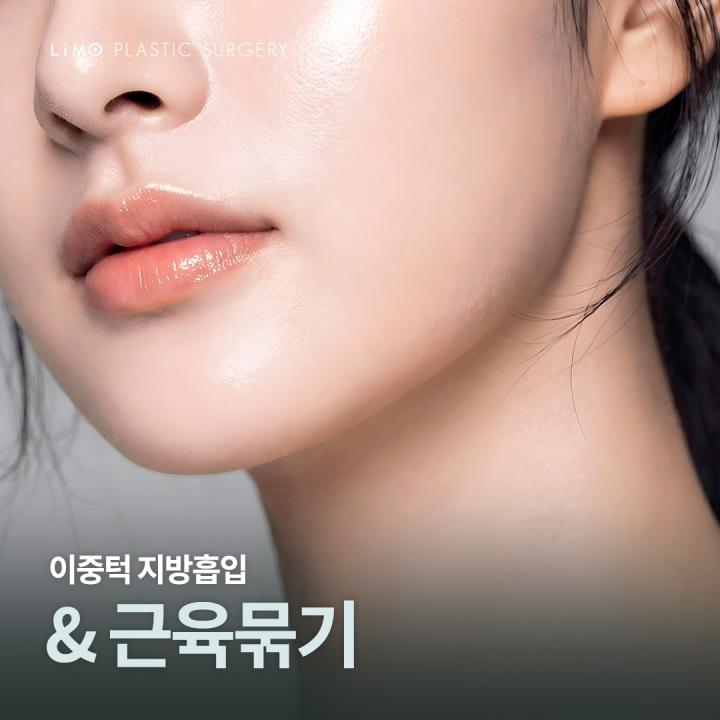 이중턱지흡근육묶기